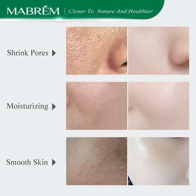 MABREM Pore Shrinking Serum Essence Pores Treatment