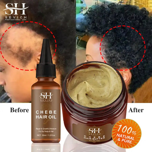 Africa Traction Alopecia Hair Growth Oil 100g Anti-break Moisturize Hair Mask Hair Loss Treatment Crazy Thicken Hair Care Sevich