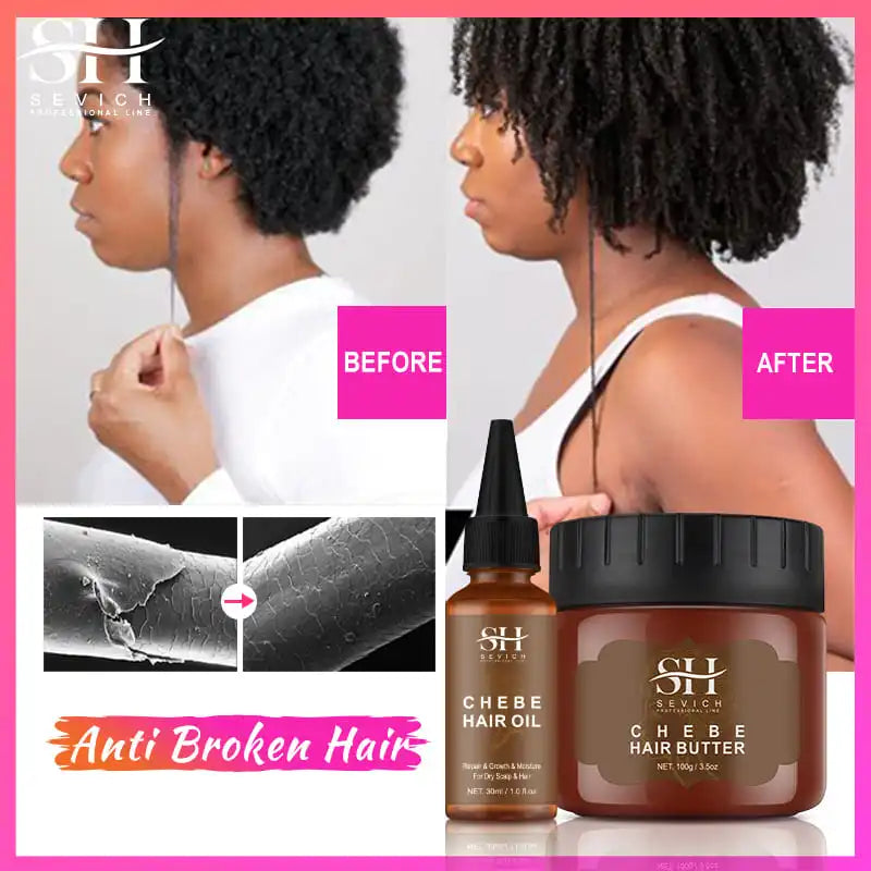 Africa Traction Alopecia Hair Growth Oil 100g Anti-break Moisturize Hair Mask Hair Loss Treatment Crazy Thicken Hair Care Sevich